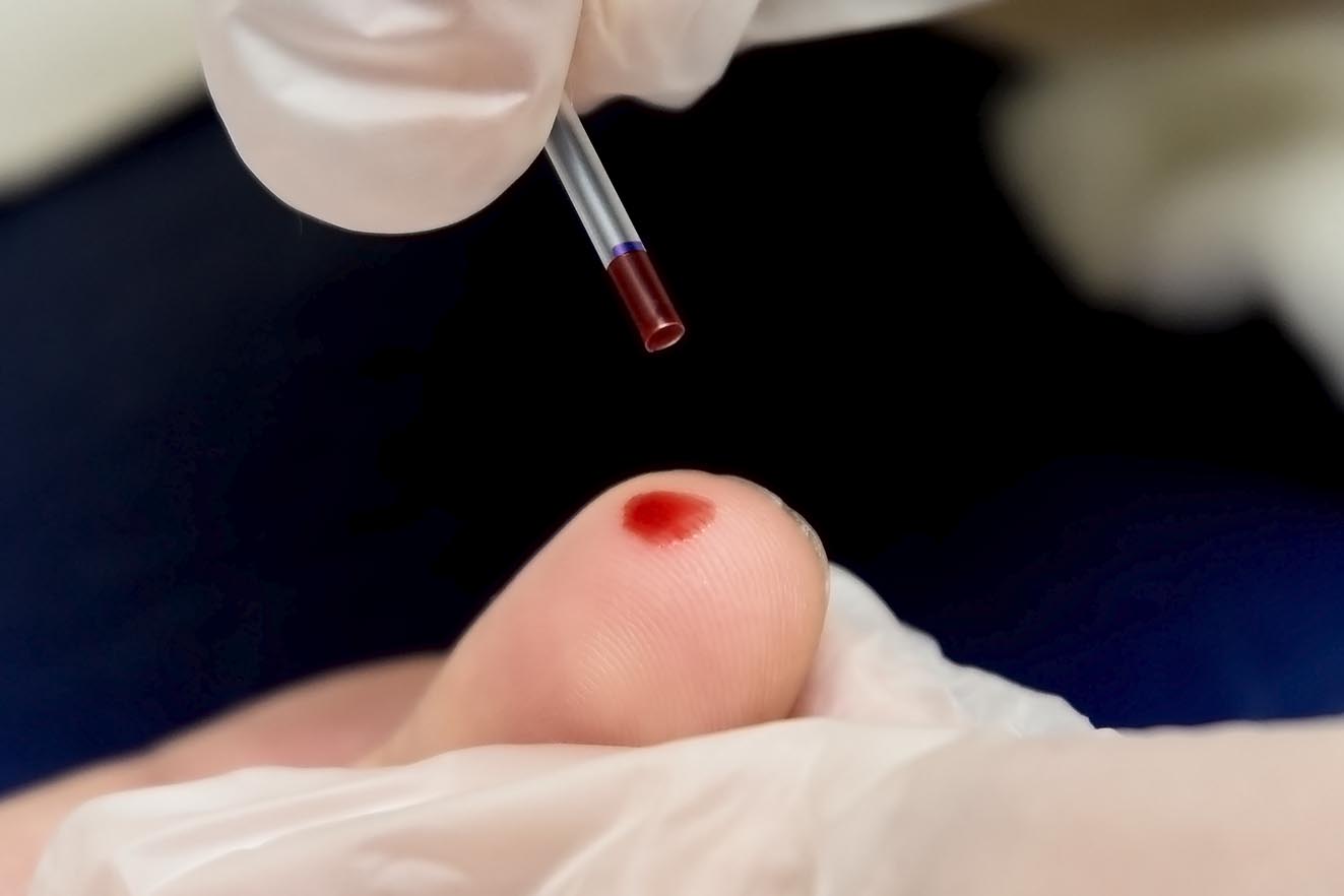 Sesau torna obrigatória notificação de hepatite B e C em Campo Grande; entenda
