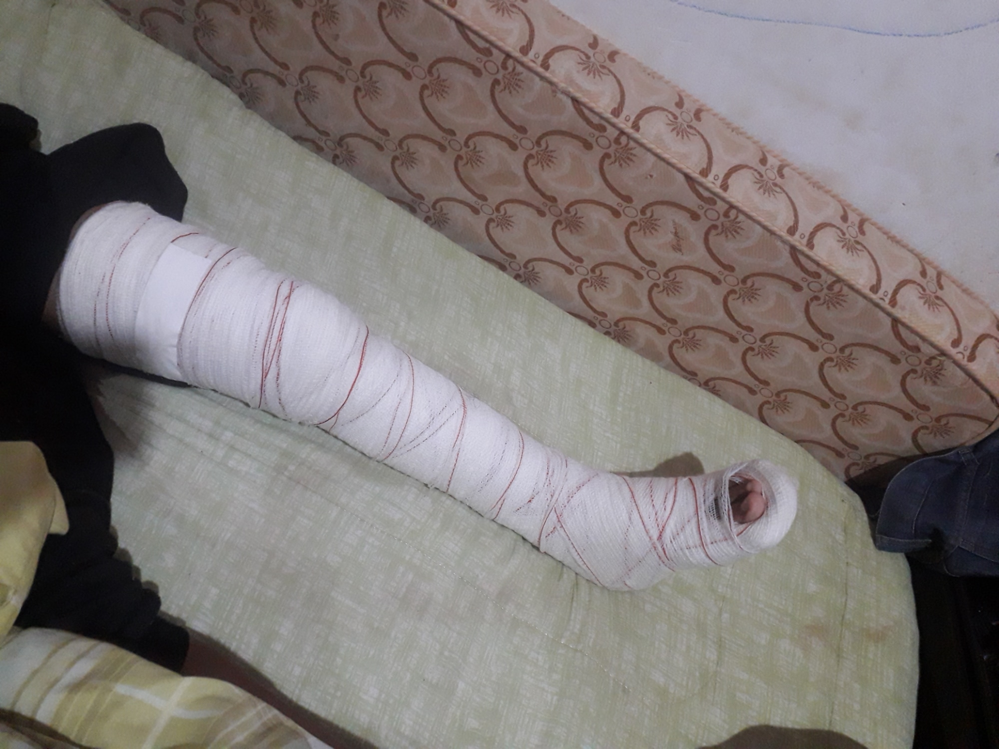 Campanha é realizada para custear tratamento (Foto: WhatsApp/Arquivo Pessoal)