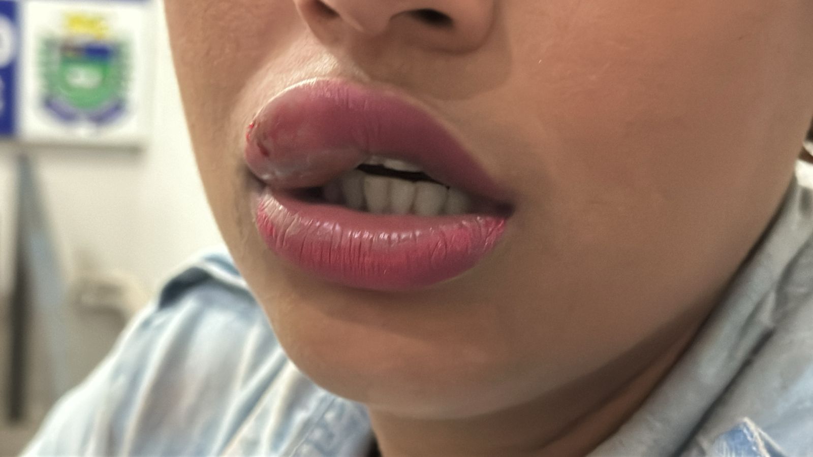 (Reprodução/Rádio Caçula)