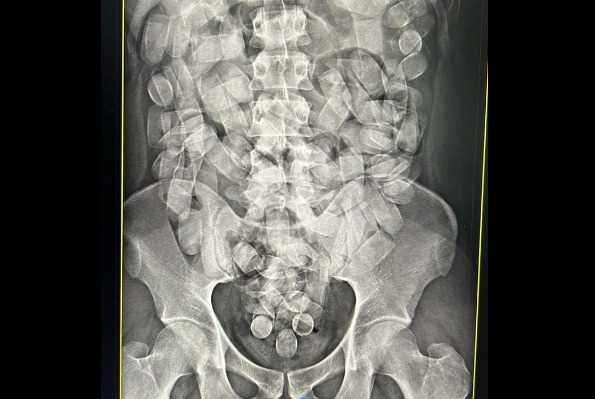 (Foto: Reprodução PFMS)