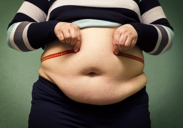 MS registra média de 15 mil novos diagnósticos de obesidade mórbida mensalmente