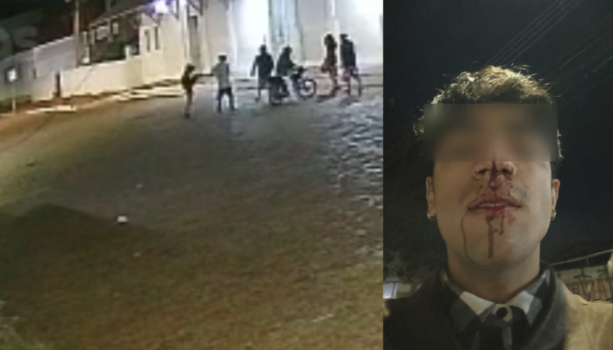 Vídeo: Jovem é espancado por grupo de homens na Capital; polícia investiga homofobia
