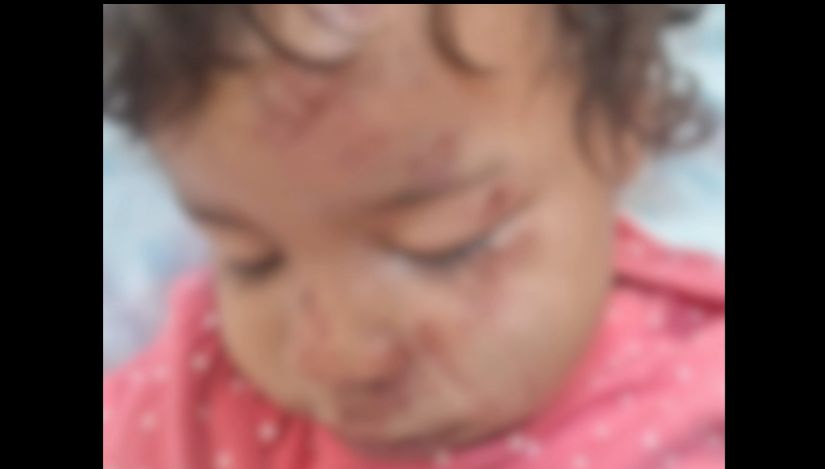 Menina de 1 ano e 8 meses é atropelada por moto no Nova Lima e morre dias depois; pais estão sendo investigados