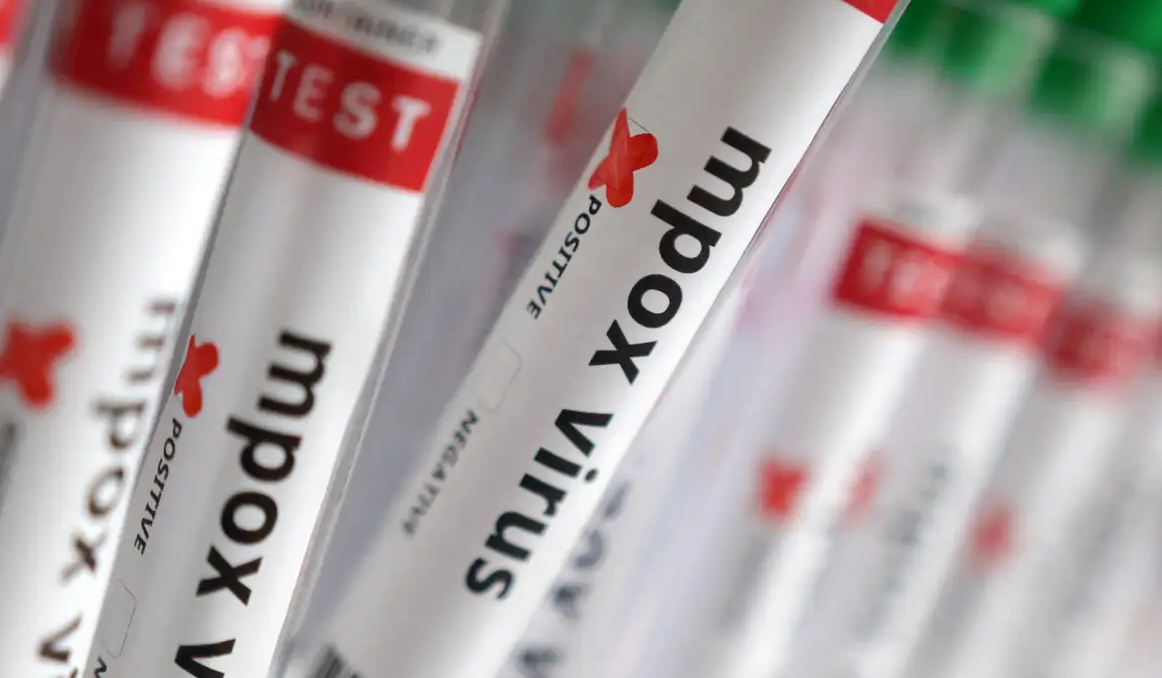 Sobe para 140 número de casos confirmados de Mpox no país, em 2026