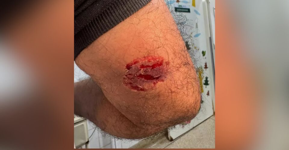 Foto: reprodução/redes sociais