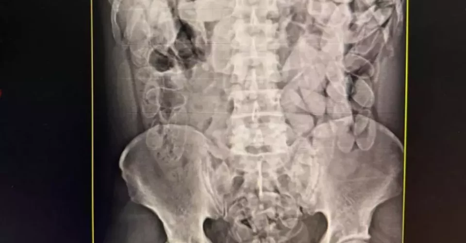 Foto: divulgação / Receita Federal