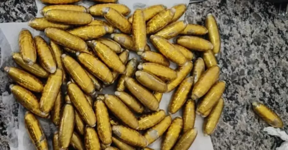 Capsulas de cocaína retiradas da estômago de boliviana - Foto: reprodução/Elenize Oliveira/Cenário MS