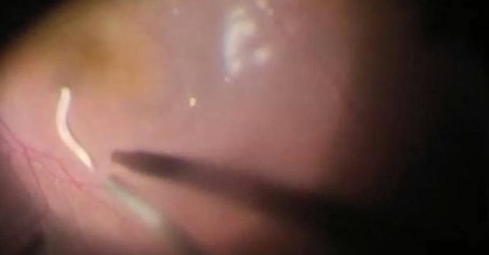 Foto: reprodução/ Metrópoles