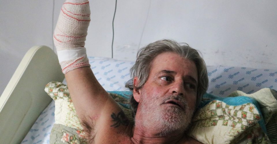 Celso Ré Neto, 49 anos,
carrega na pele e na
mente as marcas
das queimaduras - Foto: Roberta Martins