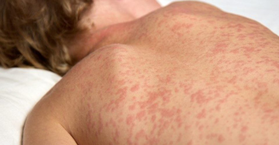 Foto: Ministério da Saúde